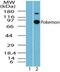 Zinc Finger And BTB Domain Containing 7A antibody, PA5-23156, Invitrogen Antibodies, Western Blot image 