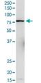 L3MBTL Histone Methyl-Lysine Binding Protein 4 antibody, H00091133-D01P, Novus Biologicals, Western Blot image 