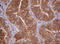 Isocitrate Dehydrogenase (NADP(+)) 1, Cytosolic antibody, LS-C336969, Lifespan Biosciences, Immunohistochemistry paraffin image 