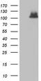 ADAM Metallopeptidase With Thrombospondin Type 1 Motif 1 antibody, LS-C798174, Lifespan Biosciences, Western Blot image 