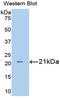 Interleukin 7 Receptor antibody, LS-C294934, Lifespan Biosciences, Western Blot image 