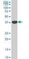 N-Myc And STAT Interactor antibody, H00009111-M03, Novus Biologicals, Western Blot image 