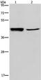 Gastrin Releasing Peptide Receptor antibody, TA321704, Origene, Western Blot image 