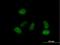 Islet Cell Autoantigen 1 Like antibody, H00130026-B01P, Novus Biologicals, Immunocytochemistry image 