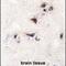 Calcium/Calmodulin Dependent Protein Kinase II Alpha antibody, PA5-14033, Invitrogen Antibodies, Immunohistochemistry frozen image 