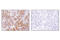Inositol Polyphosphate-4-Phosphatase Type II B antibody, 14543T, Cell Signaling Technology, Immunohistochemistry paraffin image 