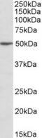 MON1 Homolog A, Secretory Trafficking Associated antibody, TA311545, Origene, Western Blot image 