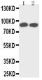 Neurotrophic Receptor Tyrosine Kinase 1 antibody, GTX12390, GeneTex, Western Blot image 