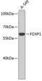 Forkhead Box P1 antibody, 18-874, ProSci, Western Blot image 