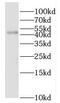 Interleukin 1 Receptor Type 2 antibody, FNab04242, FineTest, Western Blot image 