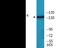 Insulin Receptor Substrate 1 antibody, EKC2079, Boster Biological Technology, Western Blot image 