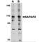 DLG Associated Protein 2 antibody, MBS151501, MyBioSource, Western Blot image 