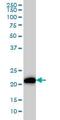 KRAS Proto-Oncogene, GTPase antibody, ab55391, Abcam, Western Blot image 