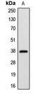 Apoptotic Peptidase Activating Factor 1 antibody, LS-C351827, Lifespan Biosciences, Western Blot image 