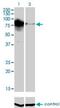 DNA Topoisomerase III Beta antibody, H00008940-M01, Novus Biologicals, Western Blot image 