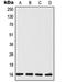 TSC22 Domain Family Member 1 antibody, orb214838, Biorbyt, Western Blot image 