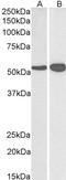 Glutamate Dehydrogenase 1 antibody, orb20463, Biorbyt, Western Blot image 