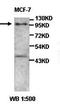 ATP Binding Cassette Subfamily A Member 5 antibody, orb77464, Biorbyt, Western Blot image 