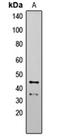 Autophagy Related 4B Cysteine Peptidase antibody, orb235026, Biorbyt, Western Blot image 