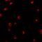Karyopherin Subunit Alpha 1 antibody, A04024, Boster Biological Technology, Immunofluorescence image 