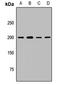 Ubiquitin Conjugating Enzyme E2 O antibody, LS-C668583, Lifespan Biosciences, Western Blot image 