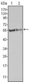 FGR Proto-Oncogene, Src Family Tyrosine Kinase antibody, abx010780, Abbexa, Enzyme Linked Immunosorbent Assay image 