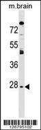 Aquaporin 1 (Colton Blood Group) antibody, 59-500, ProSci, Western Blot image 