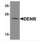 Density Regulated Re-Initiation And Release Factor antibody, MBS153601, MyBioSource, Western Blot image 