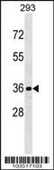 Cyclin Dependent Kinase Like 1 antibody, 62-966, ProSci, Western Blot image 