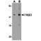 Tribbles homolog 3 antibody, TA349143, Origene, Western Blot image 
