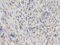 Insulin Like Growth Factor 2 MRNA Binding Protein 1 antibody, A02007, Boster Biological Technology, Immunohistochemistry frozen image 