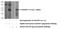 Calcium Voltage-Gated Channel Auxiliary Subunit Gamma 7 antibody, 17862-1-AP, Proteintech Group, Western Blot image 