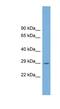 Chromosome 1 Open Reading Frame 43 antibody, NBP1-70653, Novus Biologicals, Western Blot image 