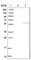 Thiosulfate Sulfurtransferase Like Domain Containing 2 antibody, HPA024241, Atlas Antibodies, Western Blot image 