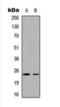 Ubiquitin Domain Containing 2 antibody, orb393181, Biorbyt, Western Blot image 