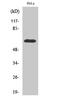 Zinc Finger Protein 18 antibody, GTX34305, GeneTex, Western Blot image 