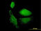 Vesicle Associated Membrane Protein 1 antibody, LS-C133460, Lifespan Biosciences, Immunofluorescence image 