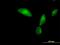Tropomodulin 3 antibody, H00029766-B01P, Novus Biologicals, Immunofluorescence image 
