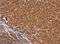 Calponin 3 antibody, NBP2-15242, Novus Biologicals, Immunohistochemistry paraffin image 