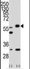 Serine/Threonine Kinase 11 antibody, PA5-14072, Invitrogen Antibodies, Western Blot image 
