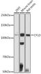 CYLD Lysine 63 Deubiquitinase antibody, GTX64513, GeneTex, Western Blot image 