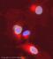 Nucleoporin 153 antibody, ab24700, Abcam, Immunocytochemistry image 