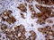 Alpha-Methylacyl-CoA Racemase antibody, LS-C794389, Lifespan Biosciences, Immunohistochemistry paraffin image 