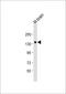 Neuronal Cell Adhesion Molecule antibody, MBS9216965, MyBioSource, Western Blot image 