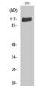 Fibroblast Growth Factor Receptor 1 antibody, STJ93081, St John