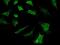 SBDS Ribosome Maturation Factor antibody, GTX02267, GeneTex, Immunocytochemistry image 
