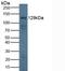 Laminin Subunit Beta 3 antibody, LS-C717566, Lifespan Biosciences, Western Blot image 