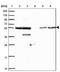 Zinc Finger Protein 300 antibody, NBP2-13566, Novus Biologicals, Western Blot image 