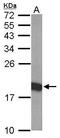 THO Complex 7 antibody, GTX119877, GeneTex, Western Blot image 