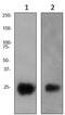 Thy-1 Cell Surface Antigen antibody, ab92574, Abcam, Western Blot image 